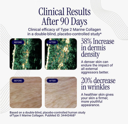 Rho Nutrition Liposomal collagen Peptides -High-Absorption Liquid Collagen supplement -Supports Skin Elasticity, Joint Health, andOverall Vitality for Healthy Aging, 5 fl oz